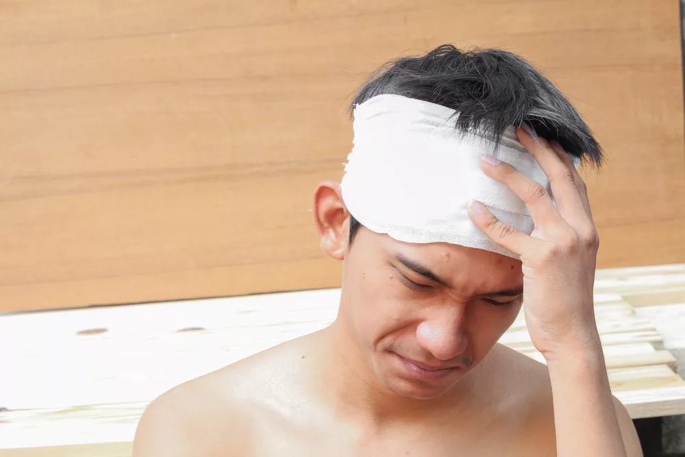 Common Types of Head Injuries After a Car Accident