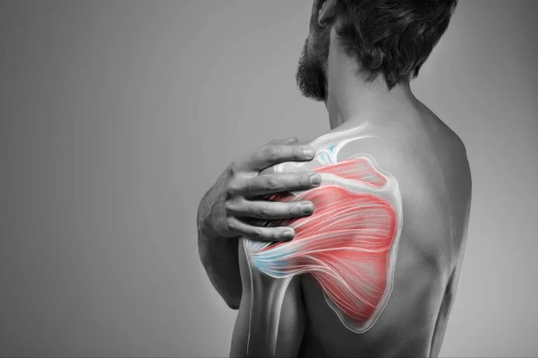 5 Common Causes for Shoulder Pain After a Car Accident